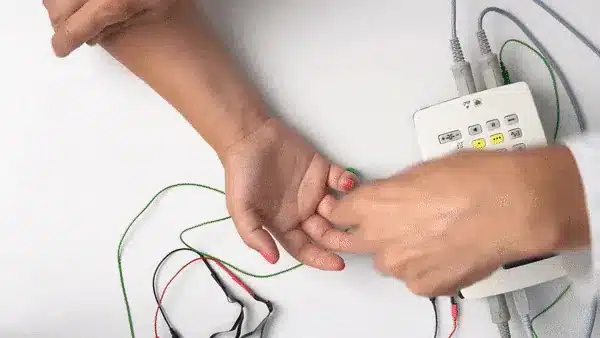 Como é feita a eletroneuromiografia (ENMG): eletrodos e estímulos de condução nervosa na mão